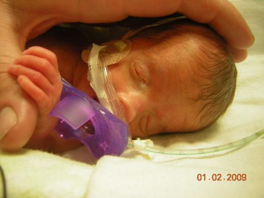 Kylie weighed 2 lbs. and 7 oz. when she was born